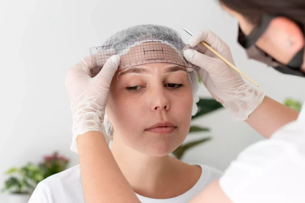 Eyebrow Transplant Turkey 1 Øjenbrynstransplantation