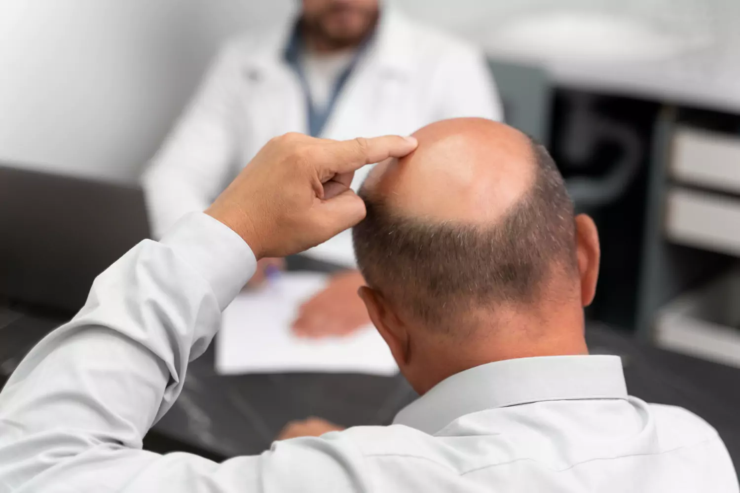 hårtransplantation