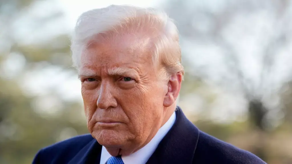 Has Donald Trump Had Hair Transplants? 1 Donald Trump Had Hair Transplant