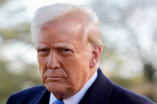 Has Donald Trump Had Hair Transplants? 6 Has Donald Trump Had Hair Transplants?